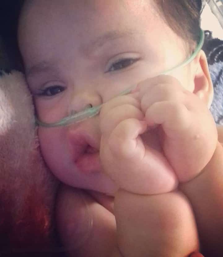 Campanha pela Ísis: bebê de 1 ano e 4 meses precisa de R$37 mil para comprar respirador que a manterá viva