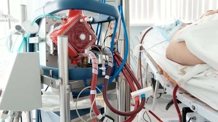 Entenda o que é ECMO, o pulmão artificial usado pelo ator e humorista Paulo Gustavo